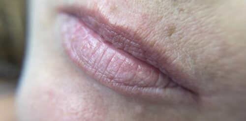 Lip Blush Before