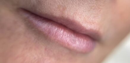 lip blushing before